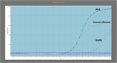 Case report: Concomitant EGFR mutation and ALK rearrangement in non-small cell lung cancer
